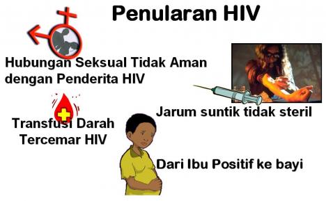 Cara Mencegah HIV AIDS novikdoraemond